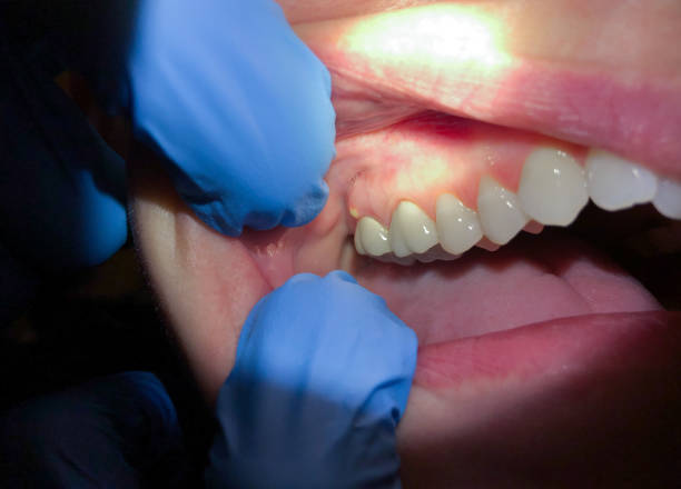 Best Same-Day Emergency Dentist in Brookwood, AL
